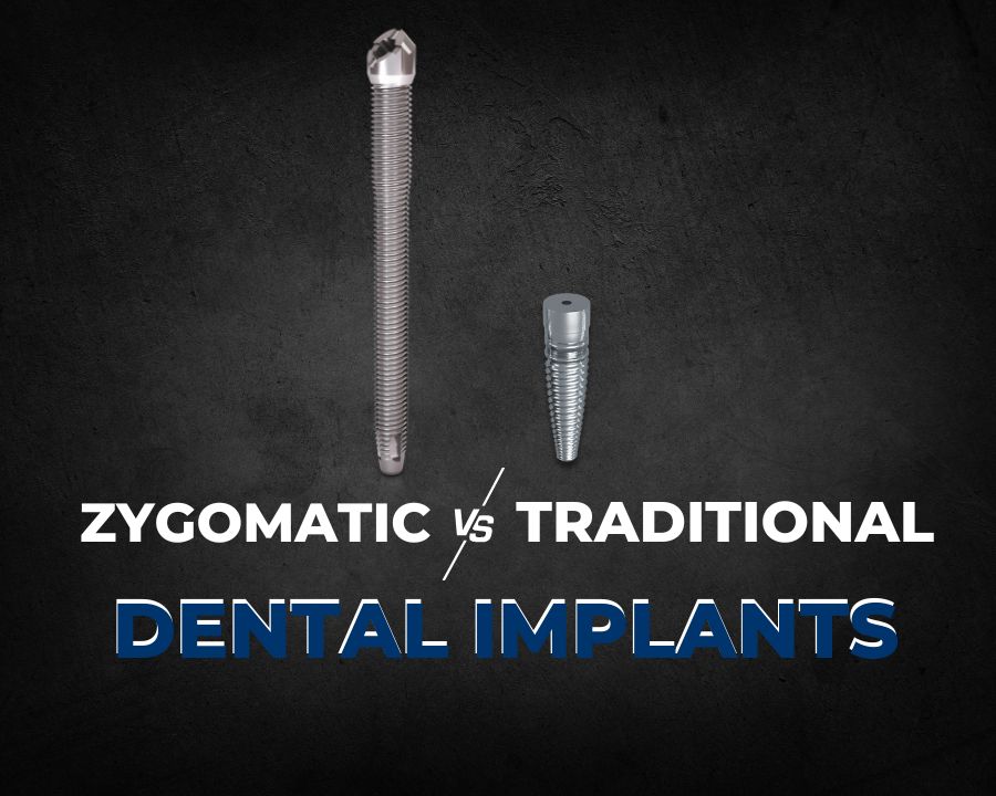 A zygomatic dental implant next to a traditional dental implant