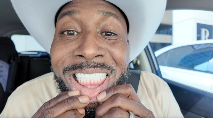 Bishop showing his full jaw dental implants