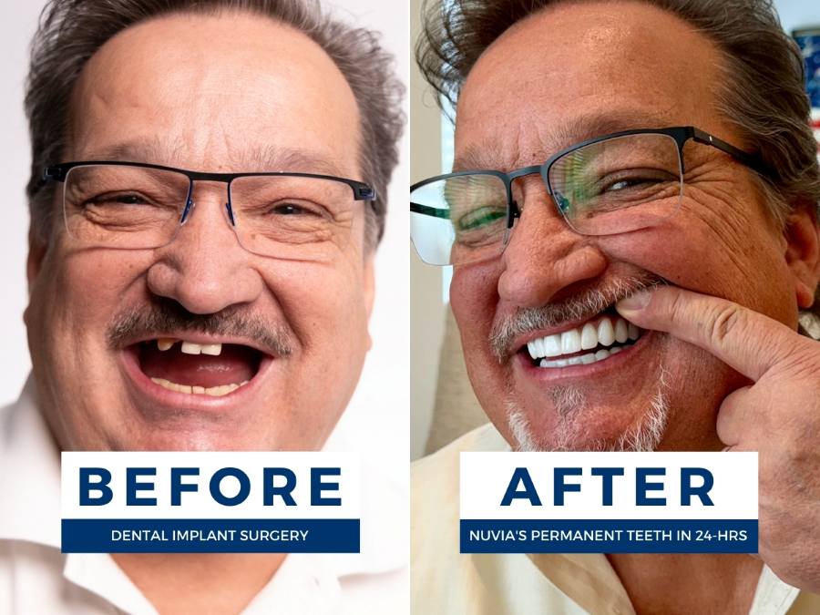 Cancer patient rick smiling before and after getting dental implants