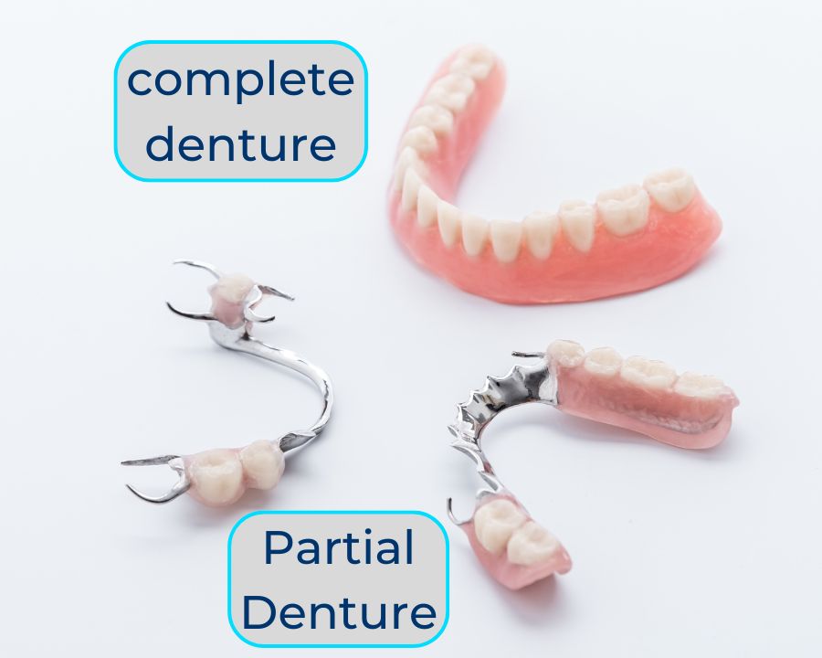 Partial denture vs a full denture