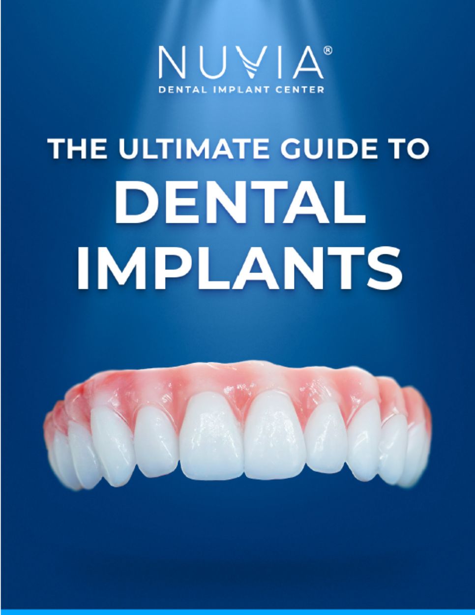 Image of Nuvia's dental implant cost guide