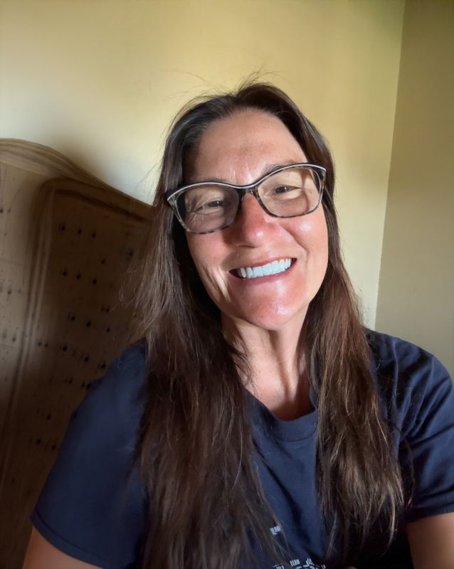Laurie smiling after healing from full mouth dental implant bruising