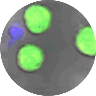 Microscope footage: a natural killer cell attacking cancer cells
