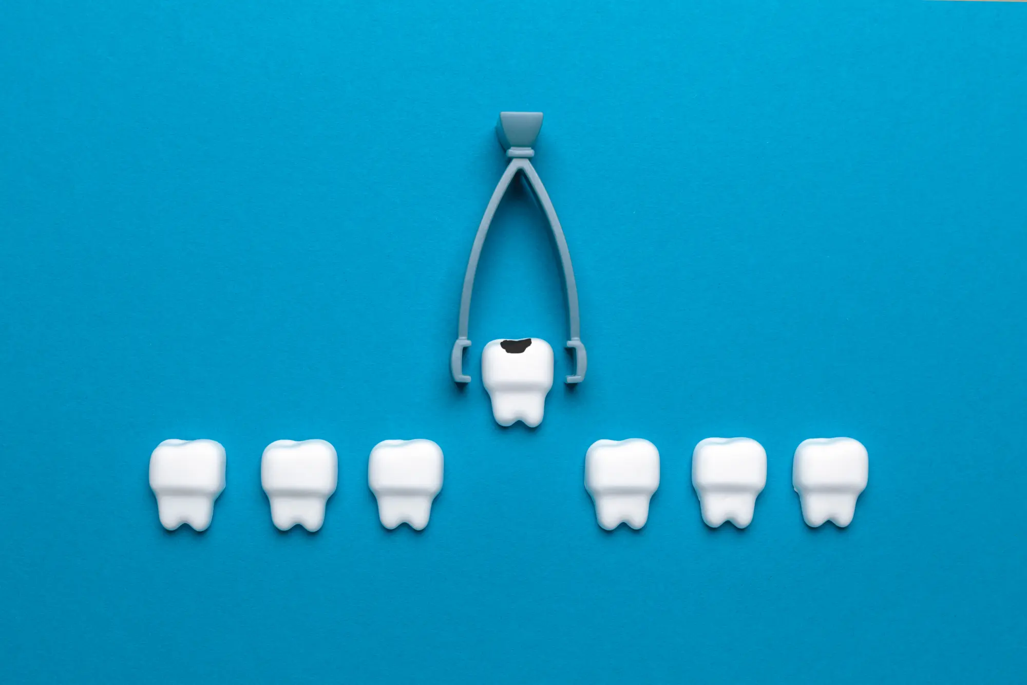 Tooth Extraction Healing Stages