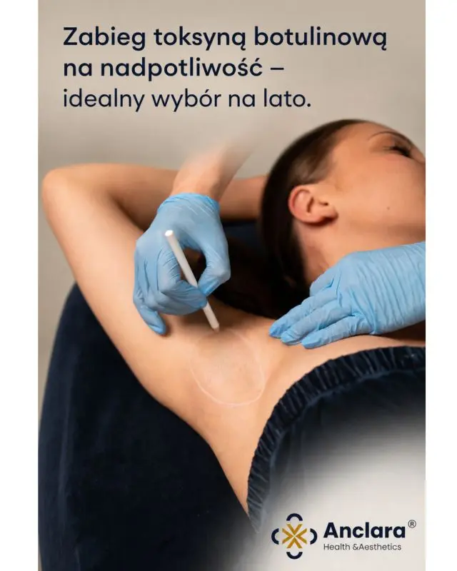 Leczenie nadpotliwości pach toksyną botulinową
