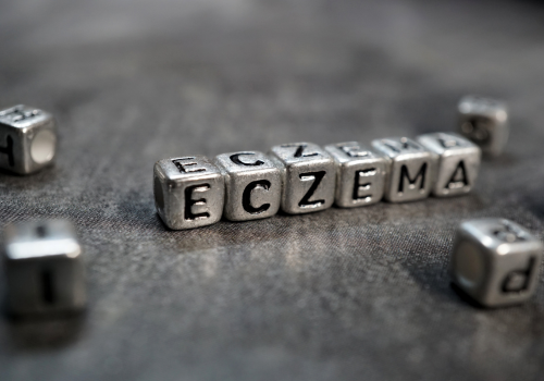 Cannabis for Eczema: Can It Help?