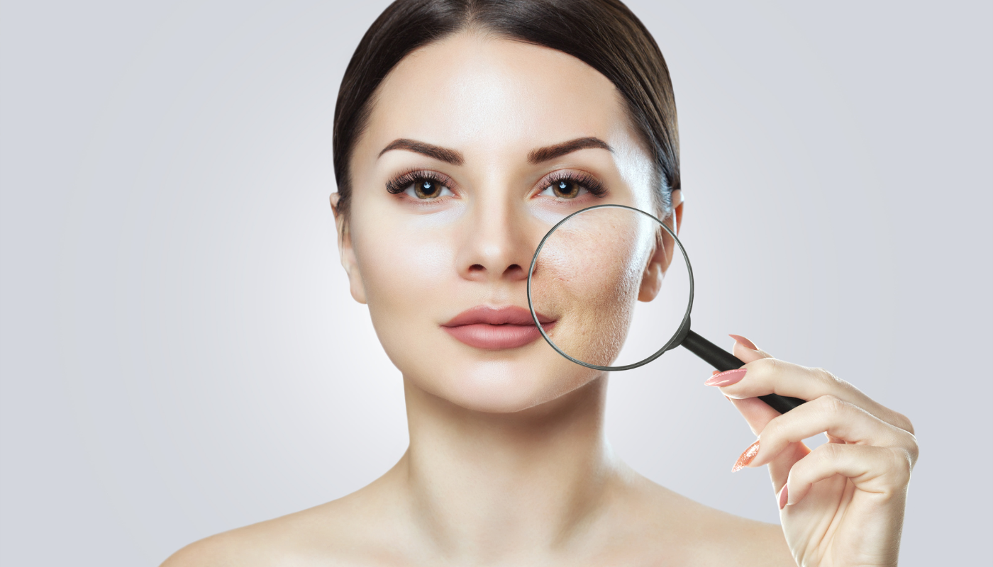 Cannabis Cream for Skin Problems: Can It Help with Eczema, Psoriasis & More?