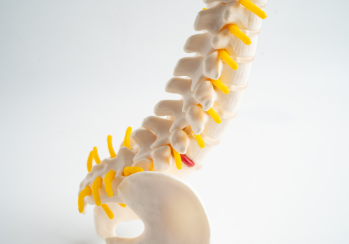 Medical Cannabis for Ankylosing Spondylitis: Understanding Symptom Relief & Access in the UK