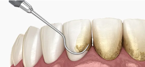 professional hygiene 3d model