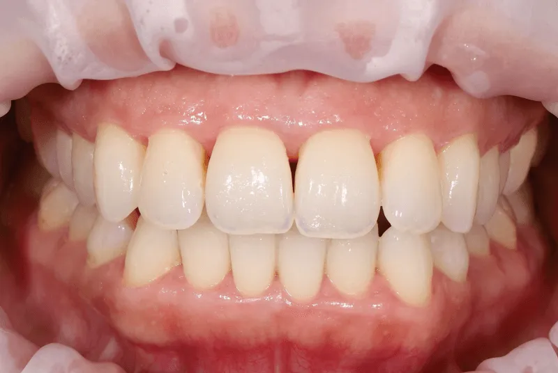 after treatment photo