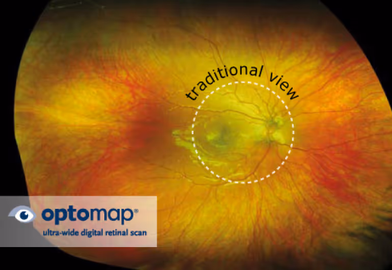 A close up of a person's eye with the words traditional view on it