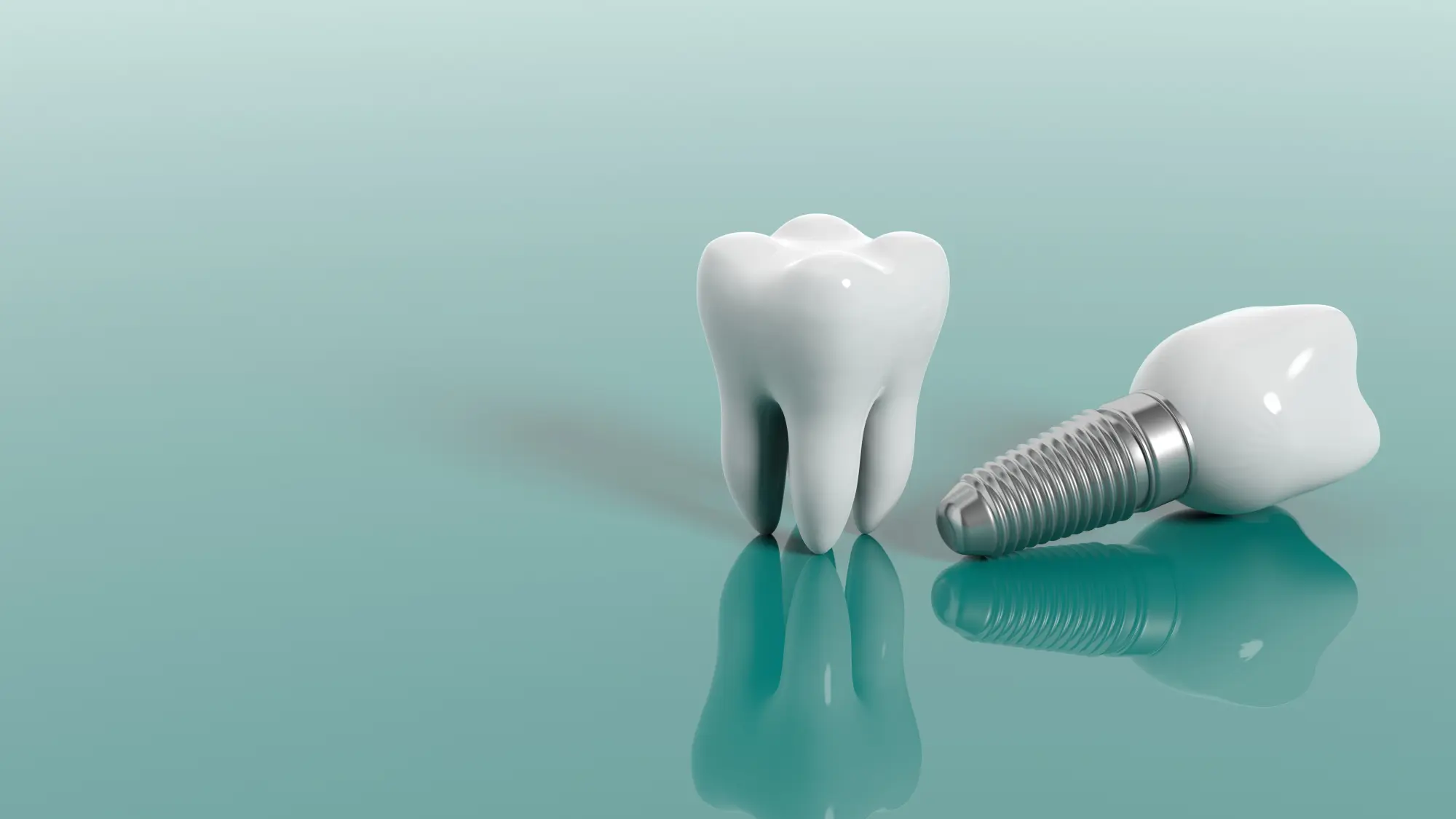 Can Dental Implants Replace Multiple Missing Teeth?