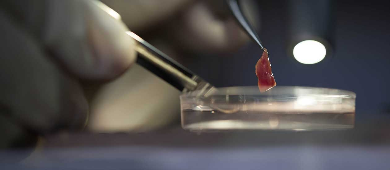 A primary human cell culture setup