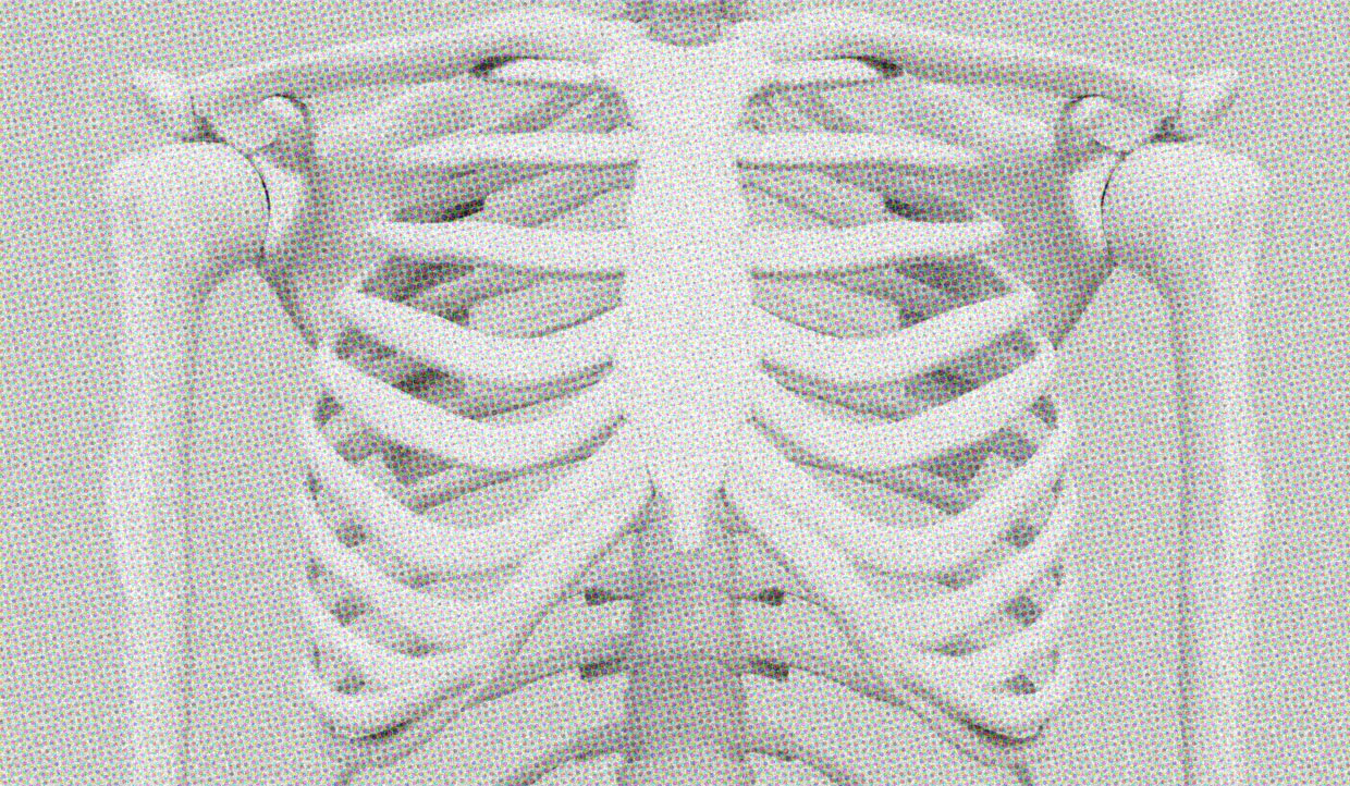 A mid shot of a skeleton's ribcage. It's hard to tell whether it's male or female.