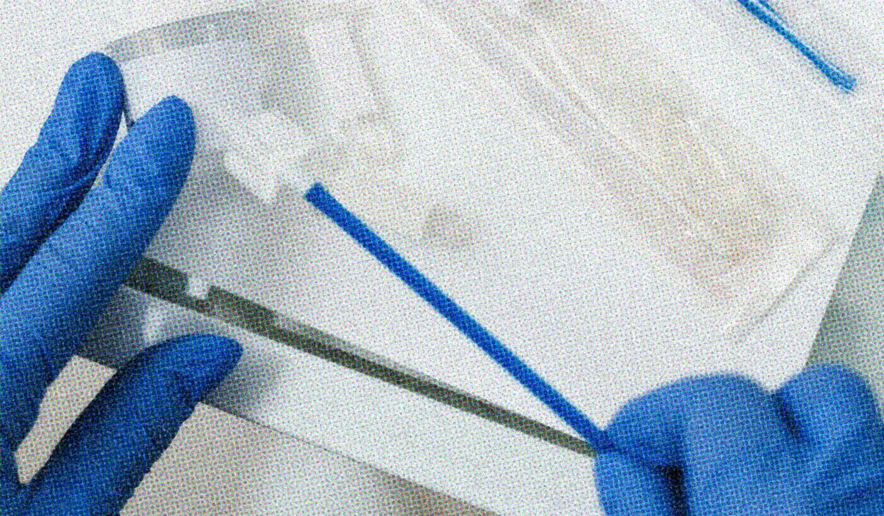 HUD App - Medical equipment - What its like to get a smear test