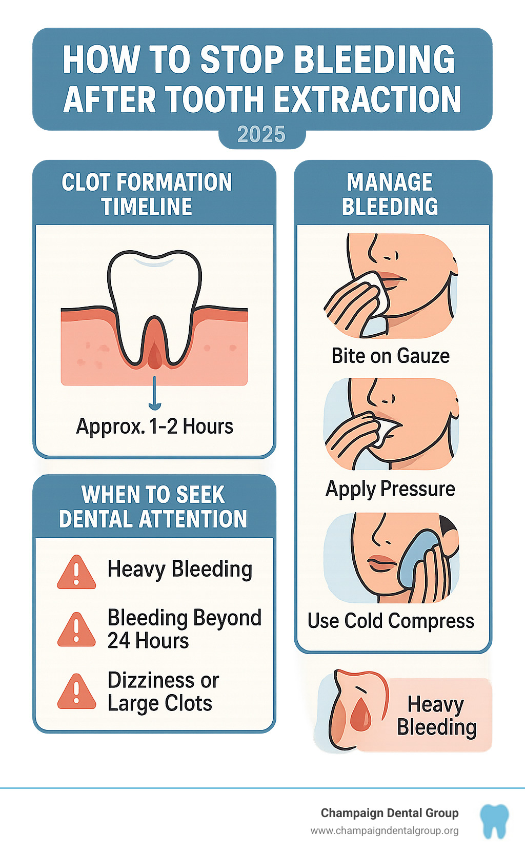Post-extraction bleeding management infographic showing timeline of clot formation, pressure application techniques, and warning signs requiring immediate dental attention - how to stop bleeding after tooth extraction infographic 