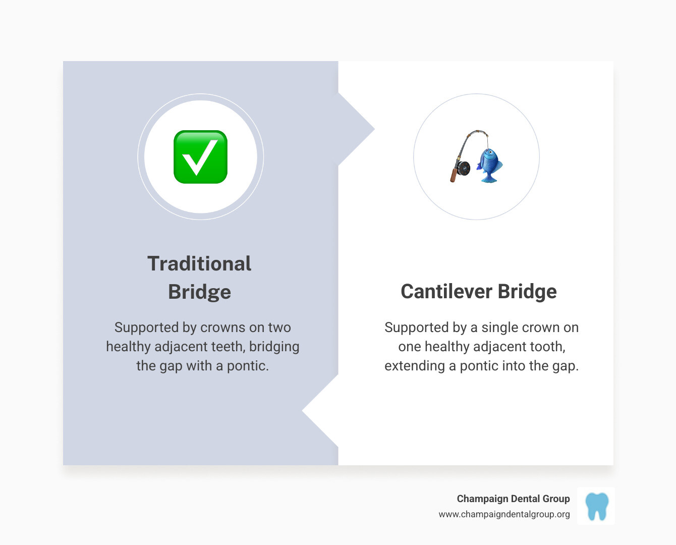 Infographic showing a traditional bridge with crowns on two teeth supporting a pontic in the middle, contrasted with a cantilever bridge where a pontic is supported by a single crown on one adjacent tooth, extending into the gap - cantilever bridge teeth infographic comparison-2-items-formal