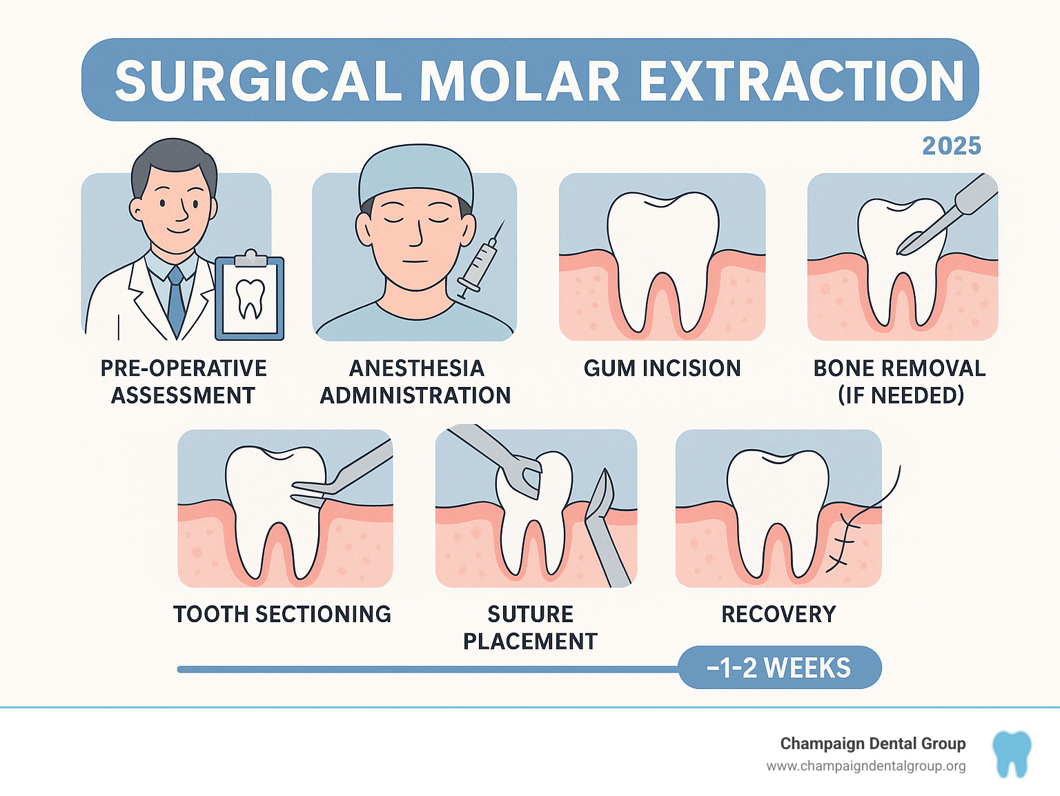 Infographic showing the step-by-step process of surgical molar extraction including pre-operative assessment, anesthesia administration, gum incision, bone removal if needed, tooth sectioning, and suture placement with typical recovery timeline - surgical molar extraction infographic 