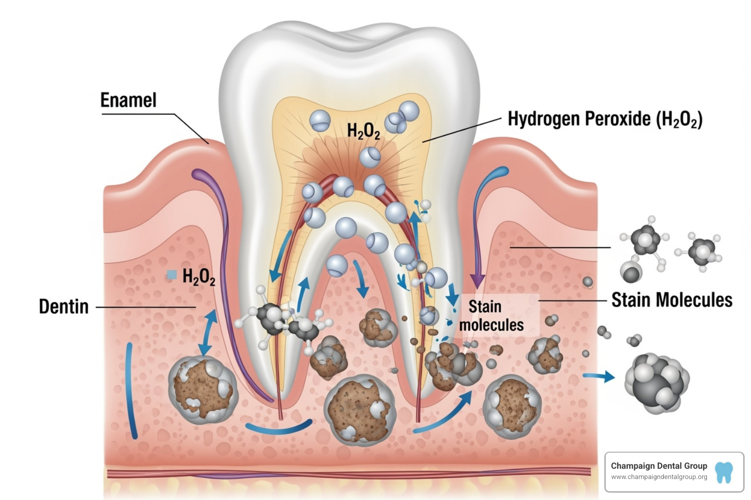 diagram showing hydrogen peroxide molecules penetrating tooth enamel and breaking down stain molecules - Teeth Whitening Methods