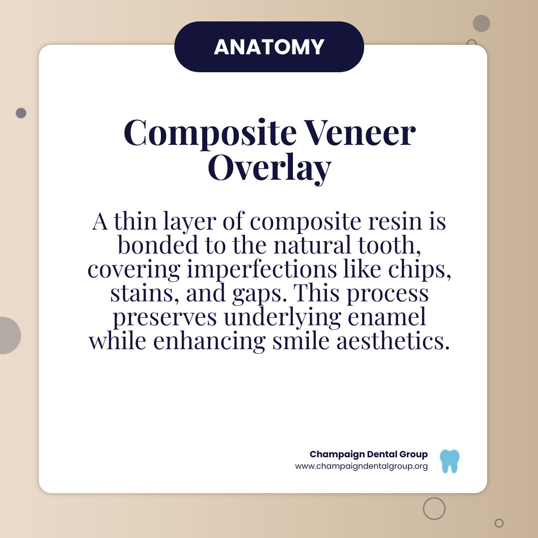 Infographic showing a cross-section of a tooth with a composite veneer bonded to the front surface, highlighting the thin layer of composite resin, the bonding adhesive, the natural tooth structure beneath, and labels indicating how veneers cover imperfections like chips, stains, and gaps while preserving most of the natural tooth enamel - Composite Veneers infographic simple-info-card