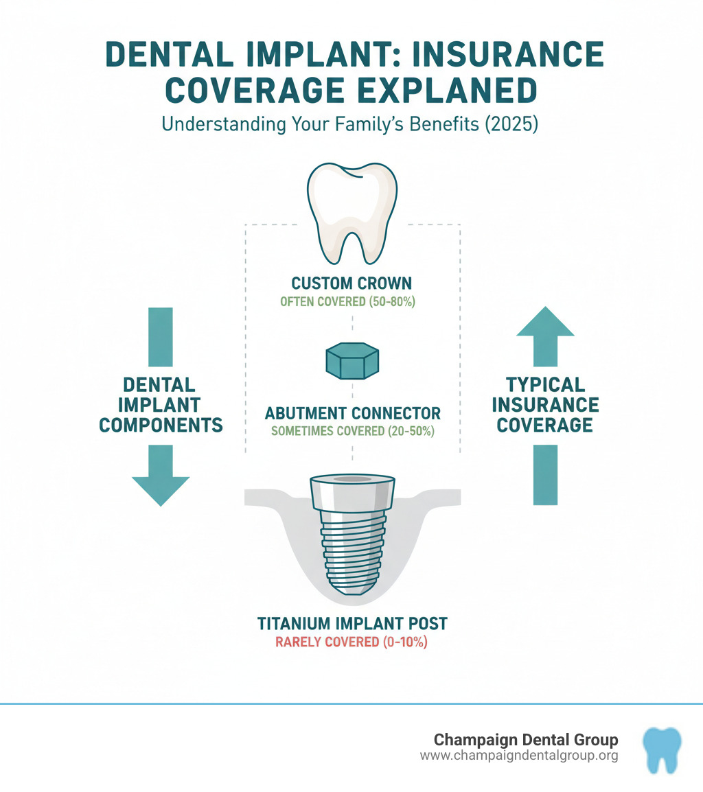 Infographic showing the three components of a dental implant: the titanium implant post that fuses with the jawbone, the abutment connector piece, and the custom crown that looks like a natural tooth. Each component is labeled with typical insurance coverage likelihood. - does insurance pay for dental implants infographic 
