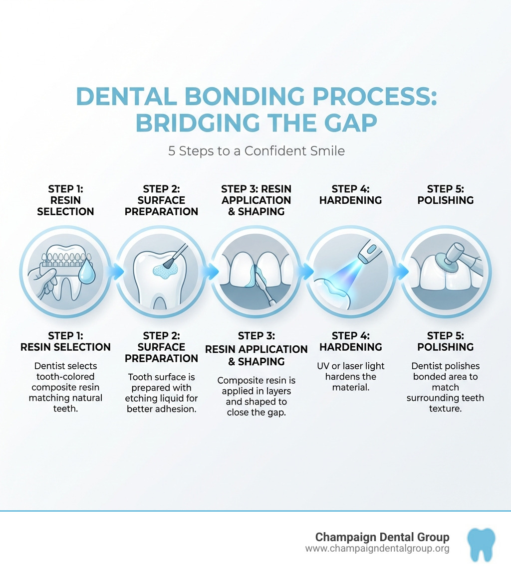Infographic showing the dental bonding process: Step 1 - Dentist selects tooth-colored composite resin matching natural teeth; Step 2 - Tooth surface is prepared with etching liquid for better adhesion; Step 3 - Composite resin is applied in layers and shaped to close the gap; Step 4 - UV or laser light hardens the material; Step 5 - Dentist polishes bonded area to match surrounding teeth texture - teeth bonding for gaps infographic 