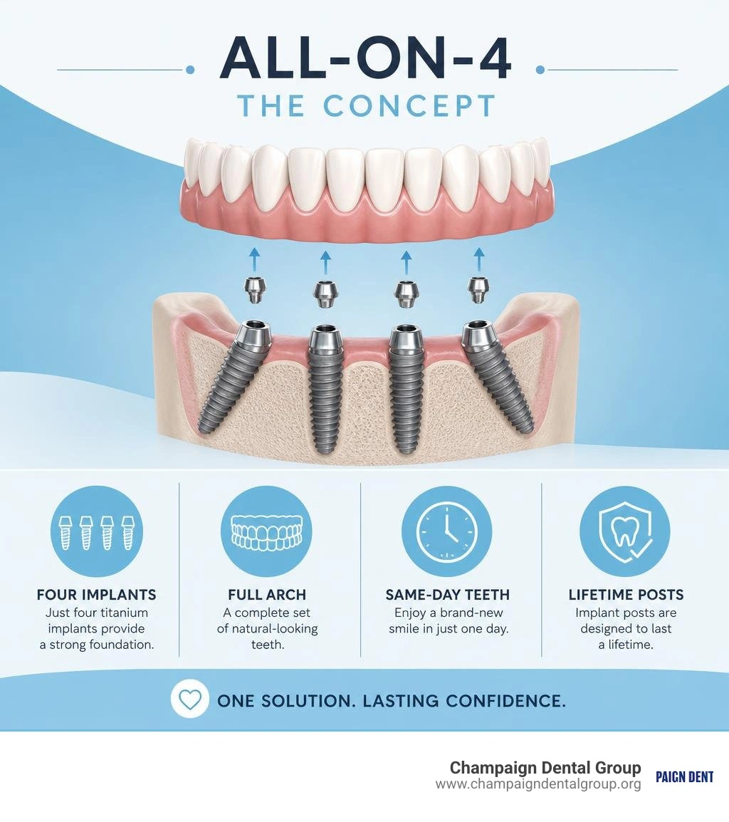 Infographic explaining the All-on-4 concept: four implants, full arch, same-day teeth, lifetime posts infographic Infographic explaining the All-on-4 concept: four implants, full arch, same-day teeth, lifetime posts infographic