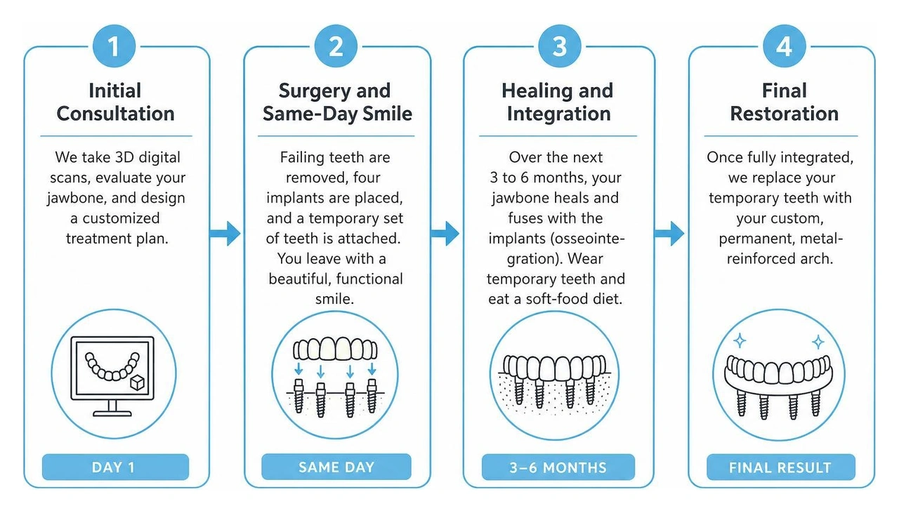 timeline of the All-on-4 dental implant process from consultation to final teeth