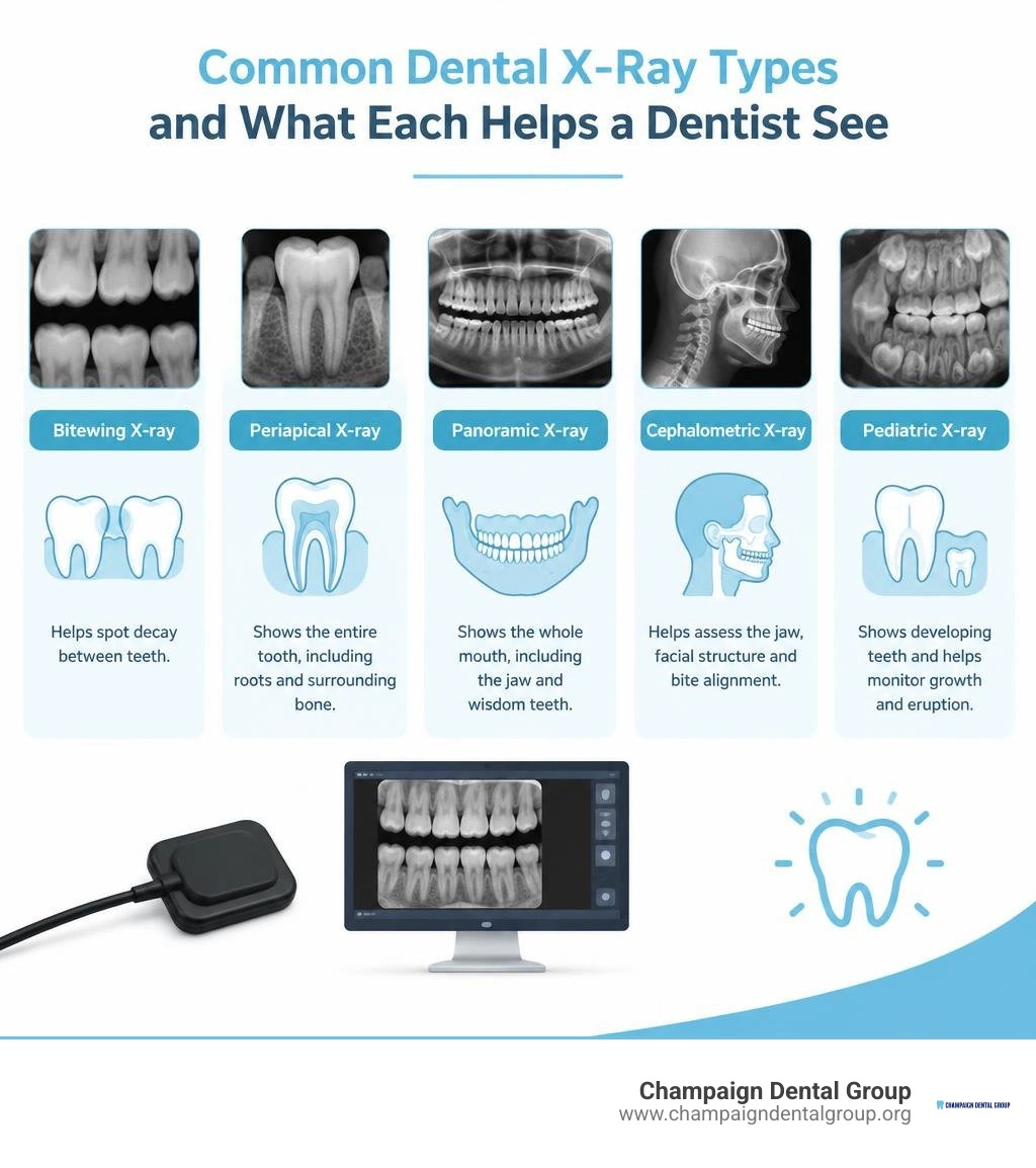 Common dental X-ray types and what each helps a dentist see infographic Common dental X-ray types and what each helps a dentist see infographic
