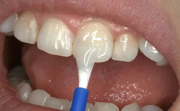 Flossing teeth demonstration