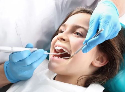 Sealants for Kids: Preventing Cavities Before They Begin