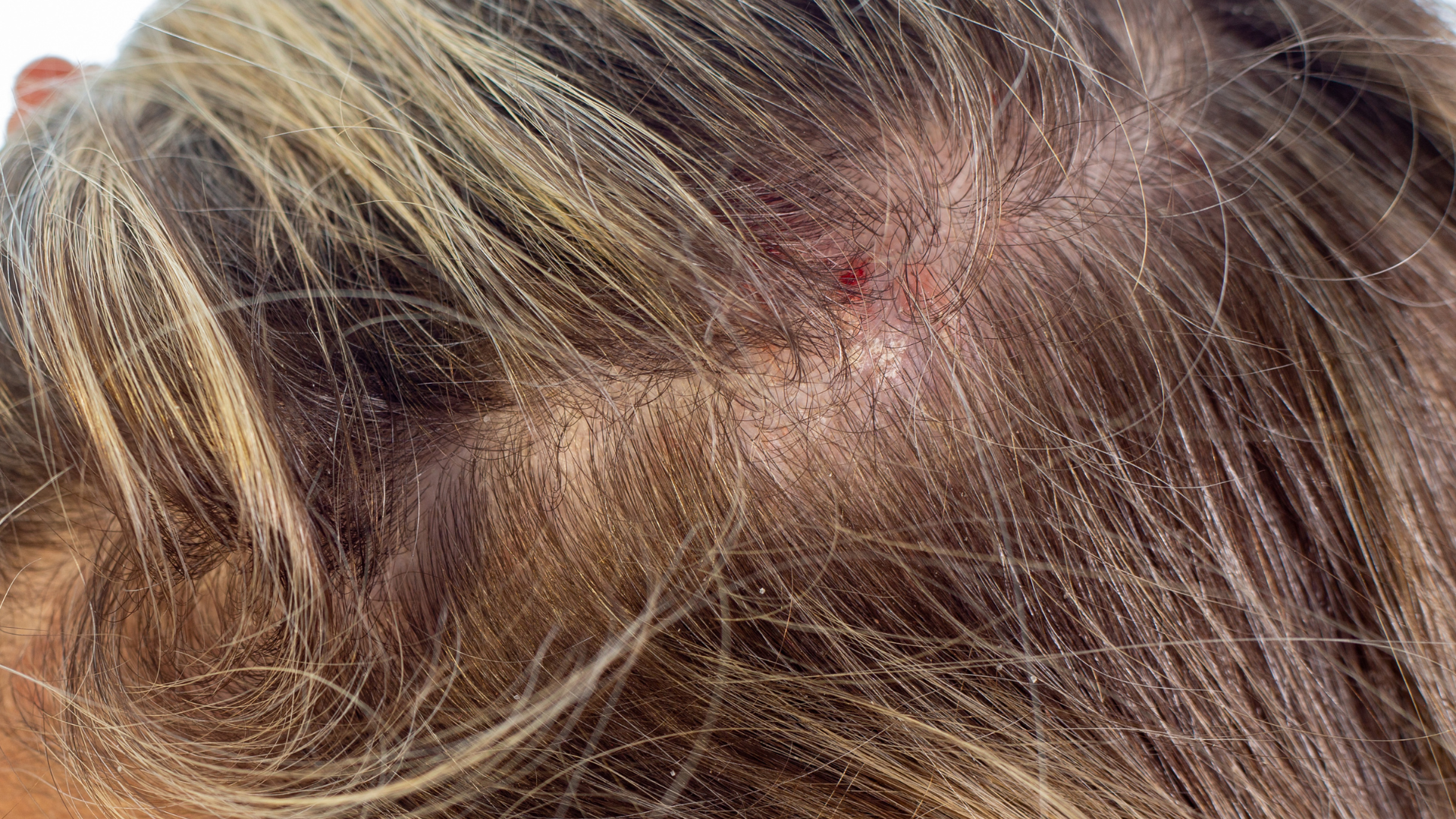 Small Sores or Rashes