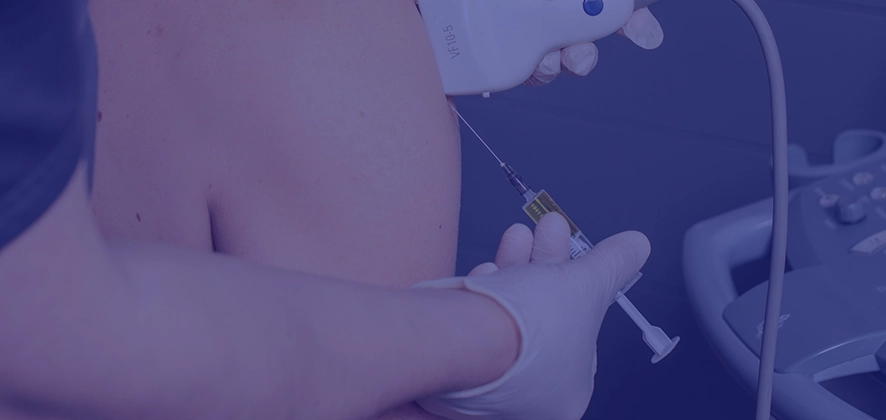 Плазмотерапія (PRP) у клініці Mashtaler Ortho&Trauma — ін’єкція власної плазми пацієнта у суглоб для зняття болю, зменшення запалення та стимуляції відновлення тканин.