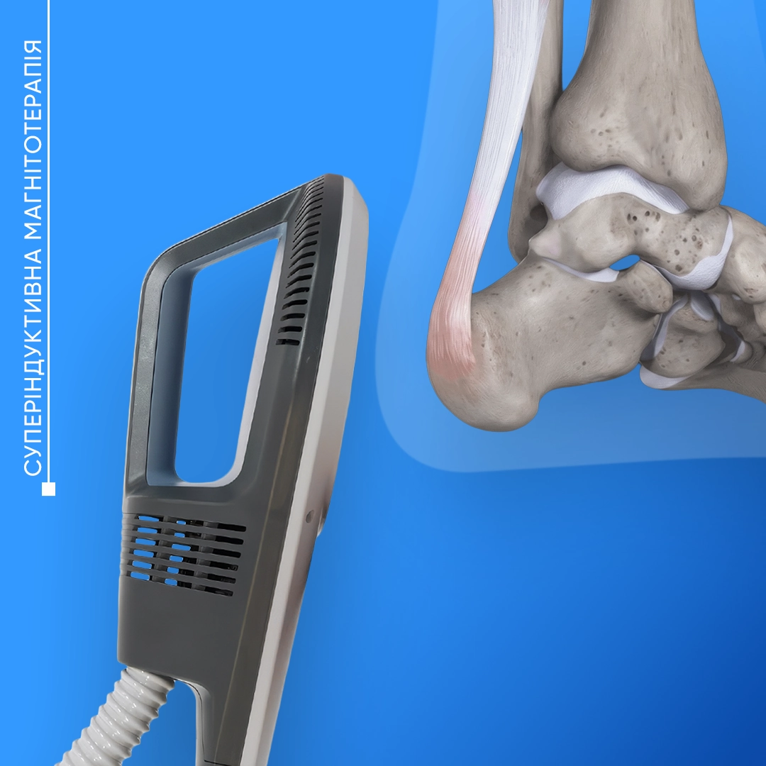 Суперіндуктивна магнітотерапія у Львові для лікування болю у суглобах, сухожиллях і м’язах та прискорення відновлення тканин.