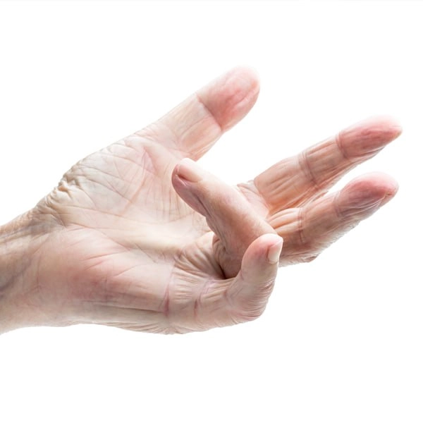 Чому виникає клацаючий палець: біль, блокування, скутість. Діагностика та лікування у Львові Mashtaler Ortho&Trauma.