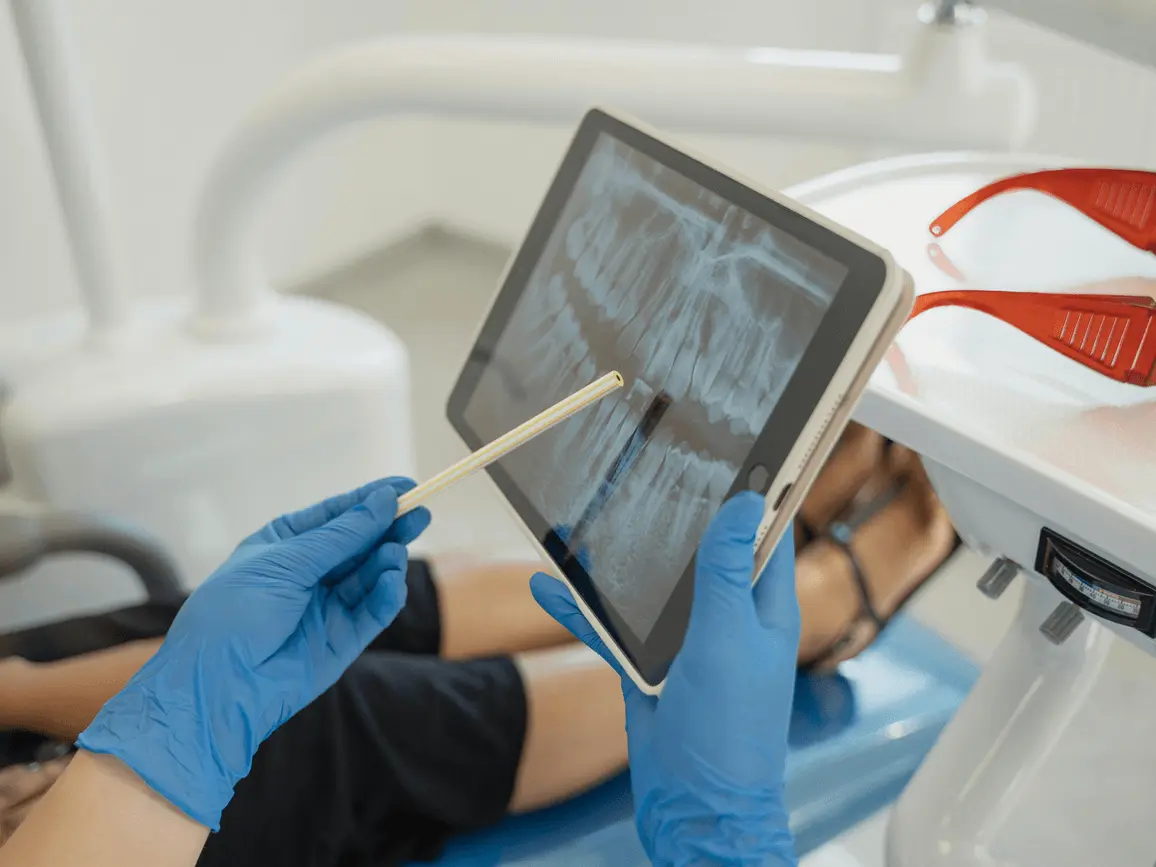 The best Mountain View endodontist shows a patient a dental x-ray indicating why root canal therapy is necessary.