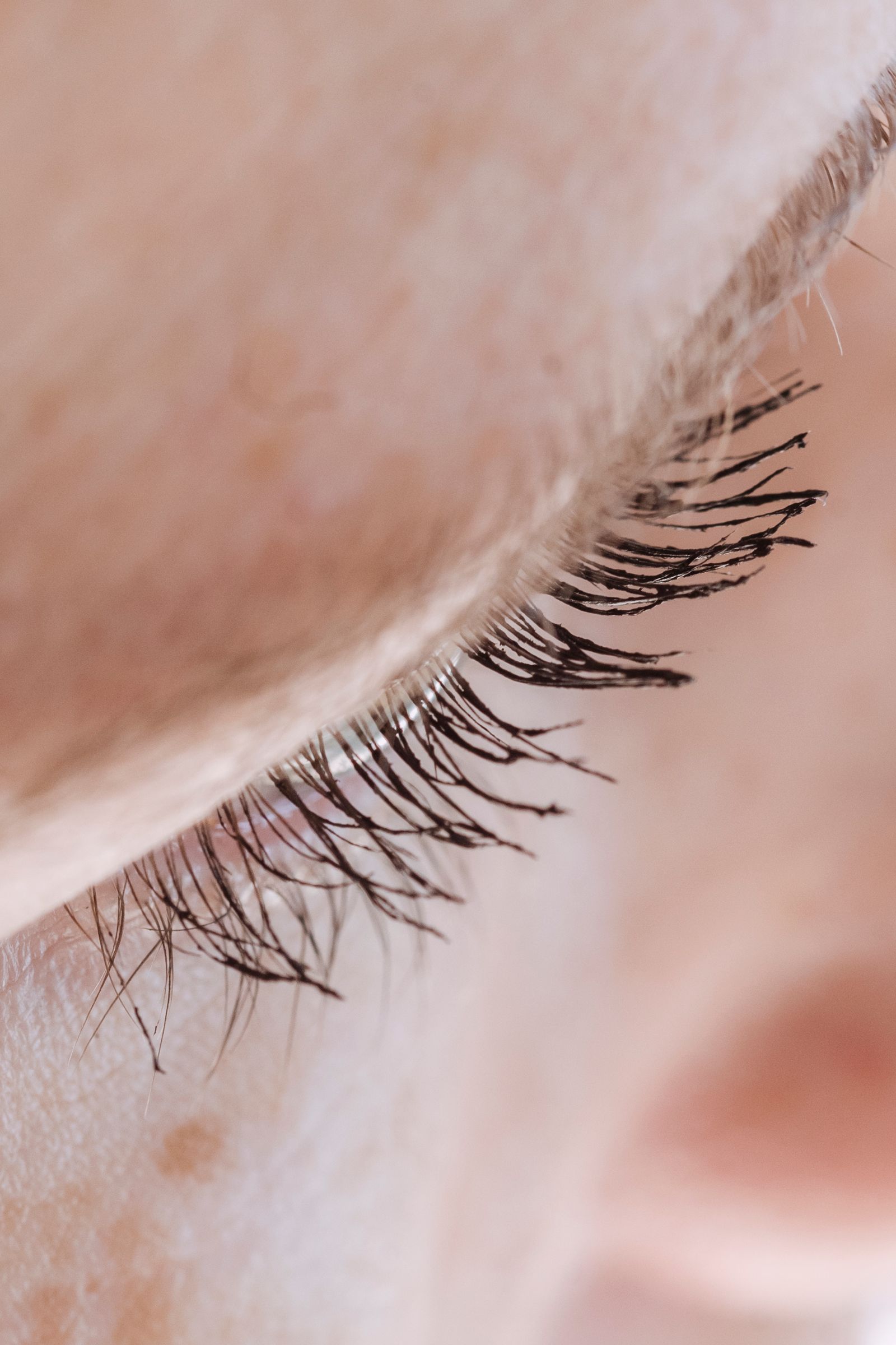 How to Get a Latisse Prescription Online: What a Legitimate Visit Includes