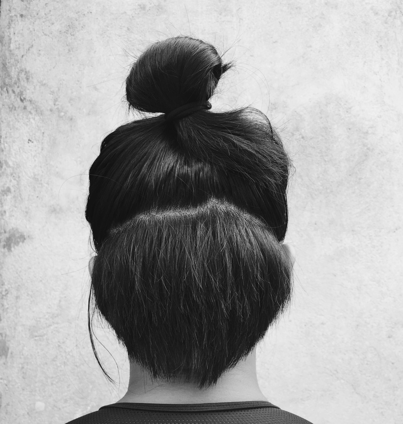 Traction Alopecia Treatment Online