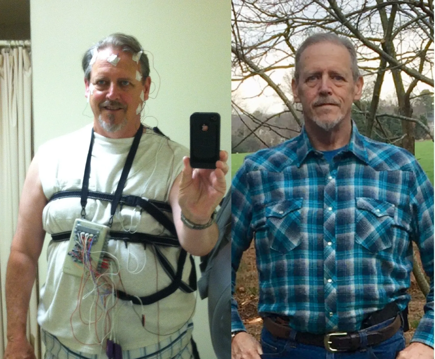 Carnivore Diet Before and After Photos