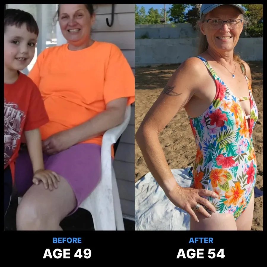 Carnivore Diet Before and After Photos
