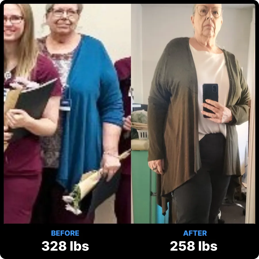 5-Month Carnivore Results