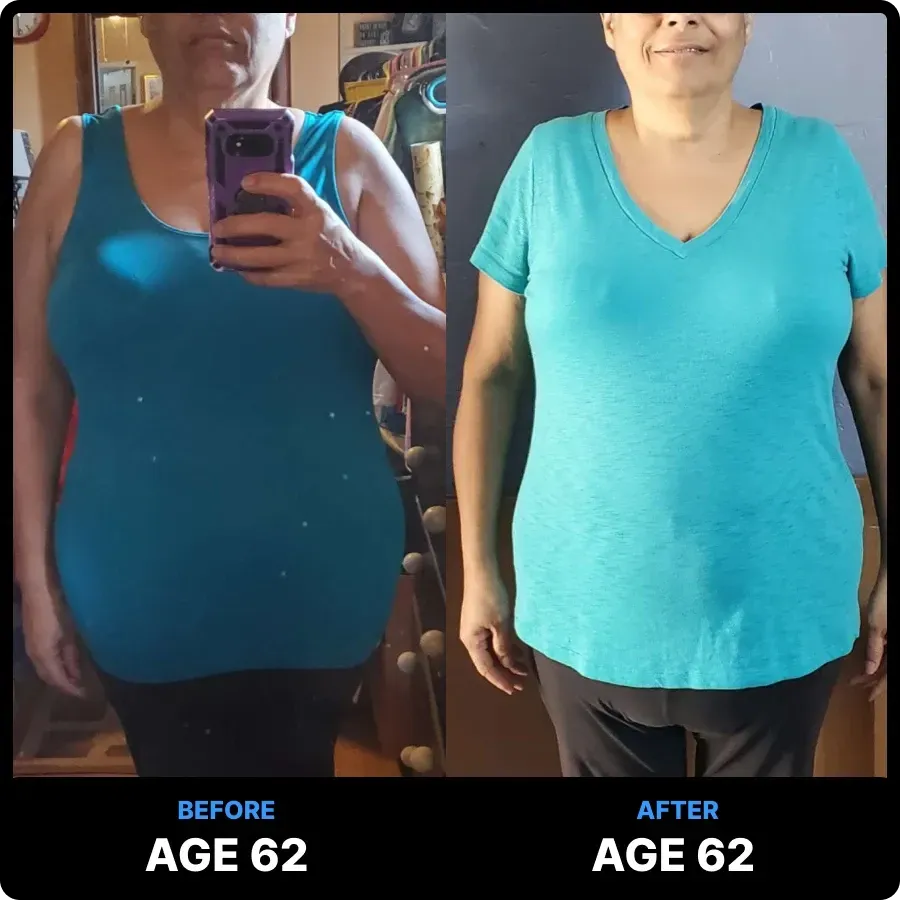 Carnivore Diet Before and After Photos