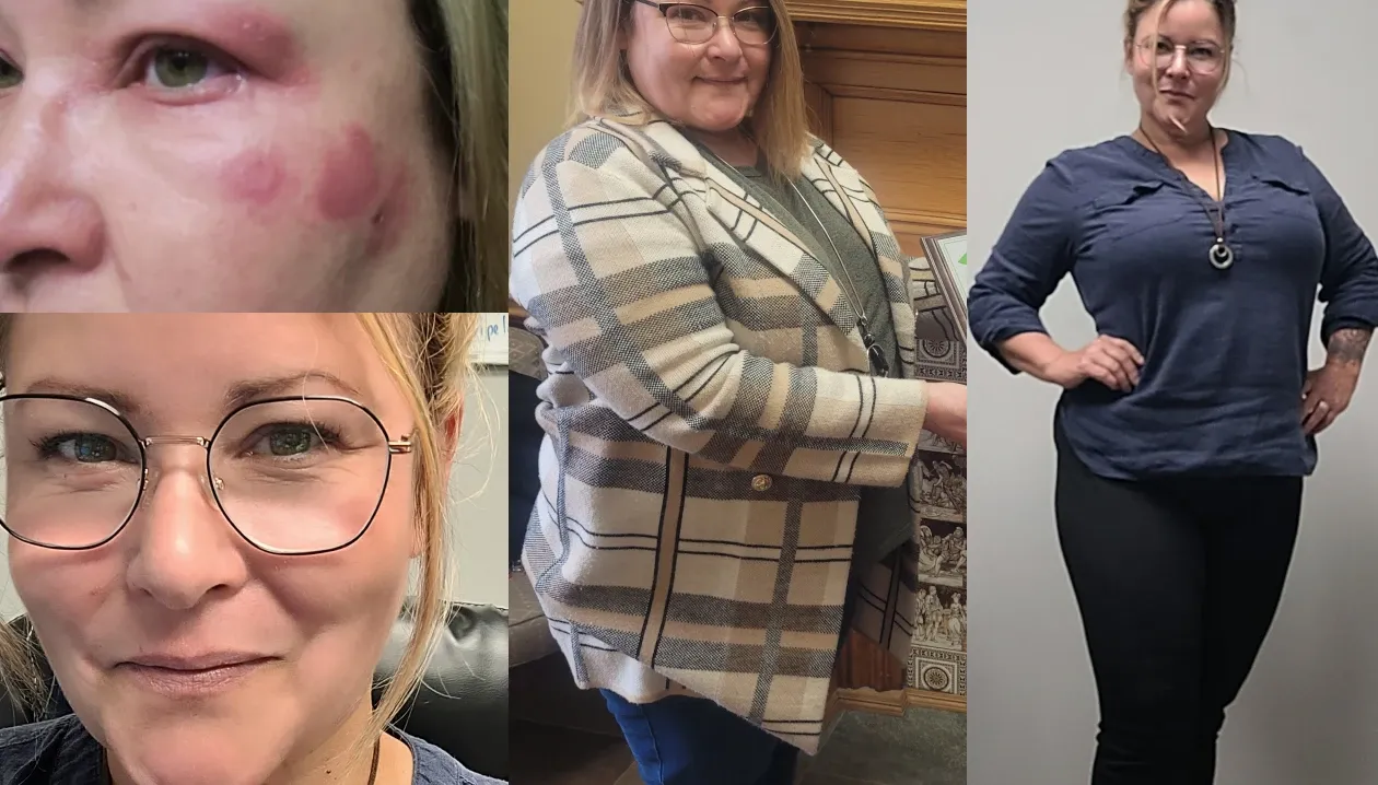 Carnivore Diet Before and After Photos