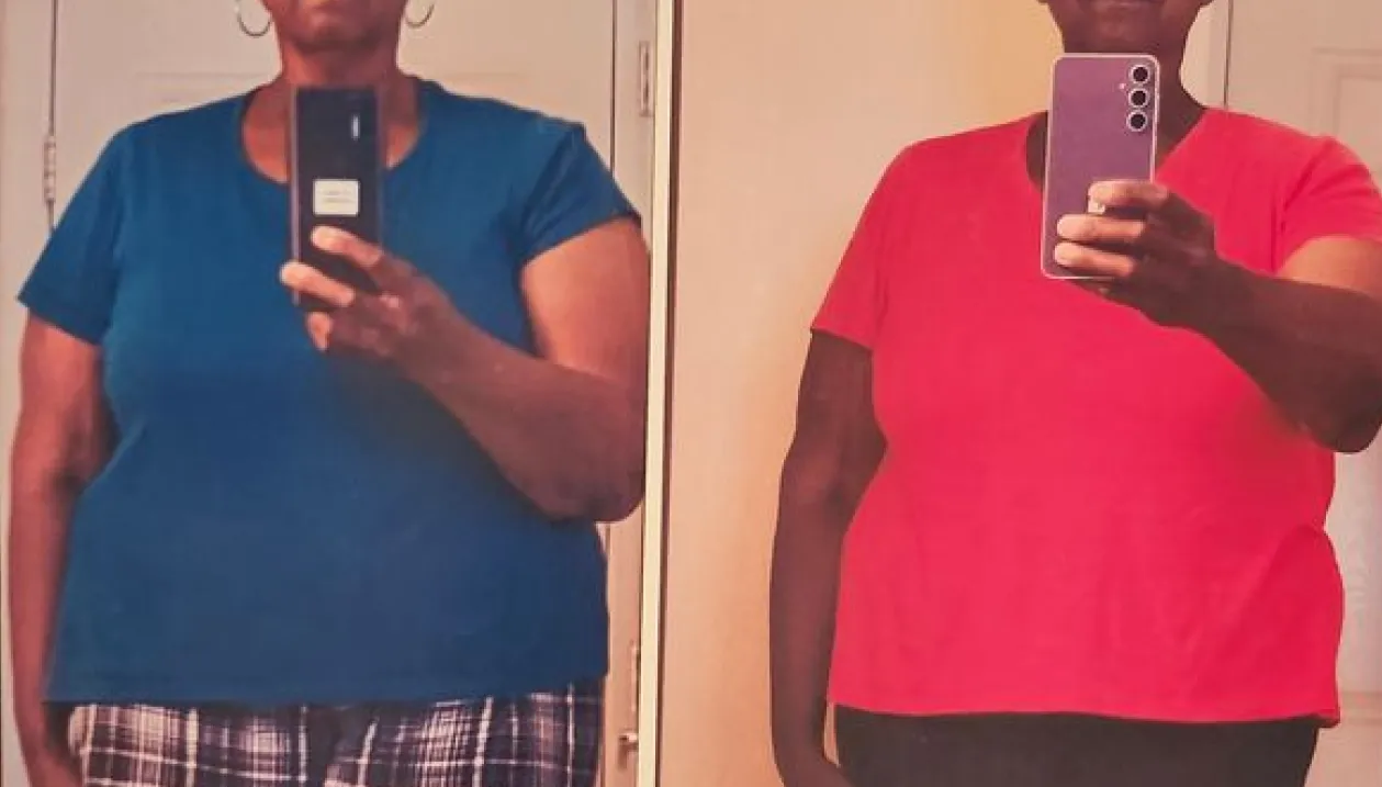 Carnivore Diet Before and After Photos