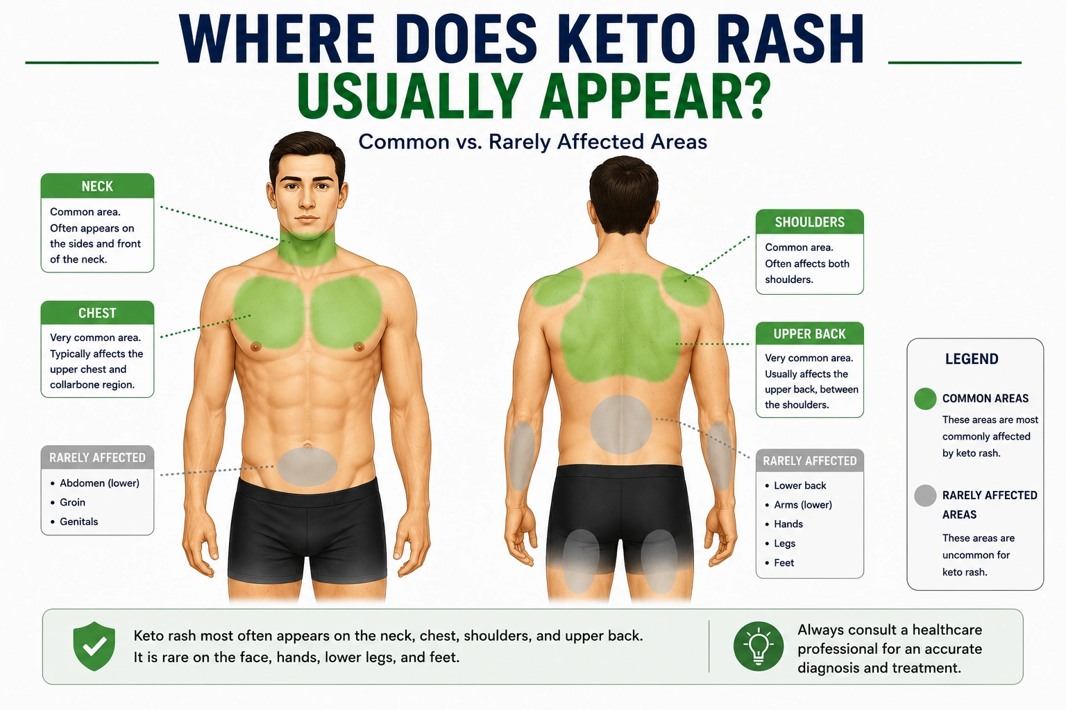Where Does Keto Diet Rash Appear