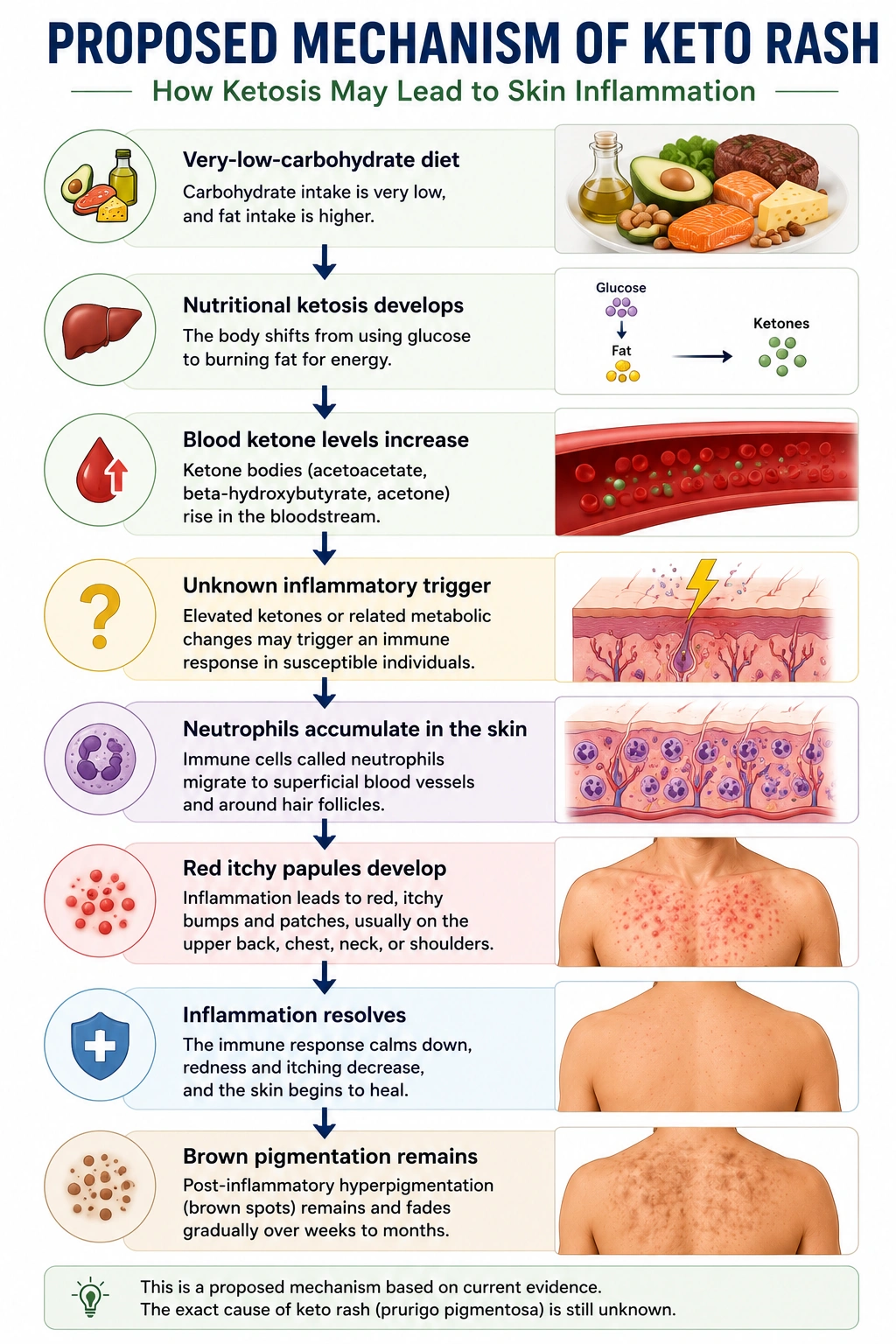 Mechanism of Keto Diet Rash