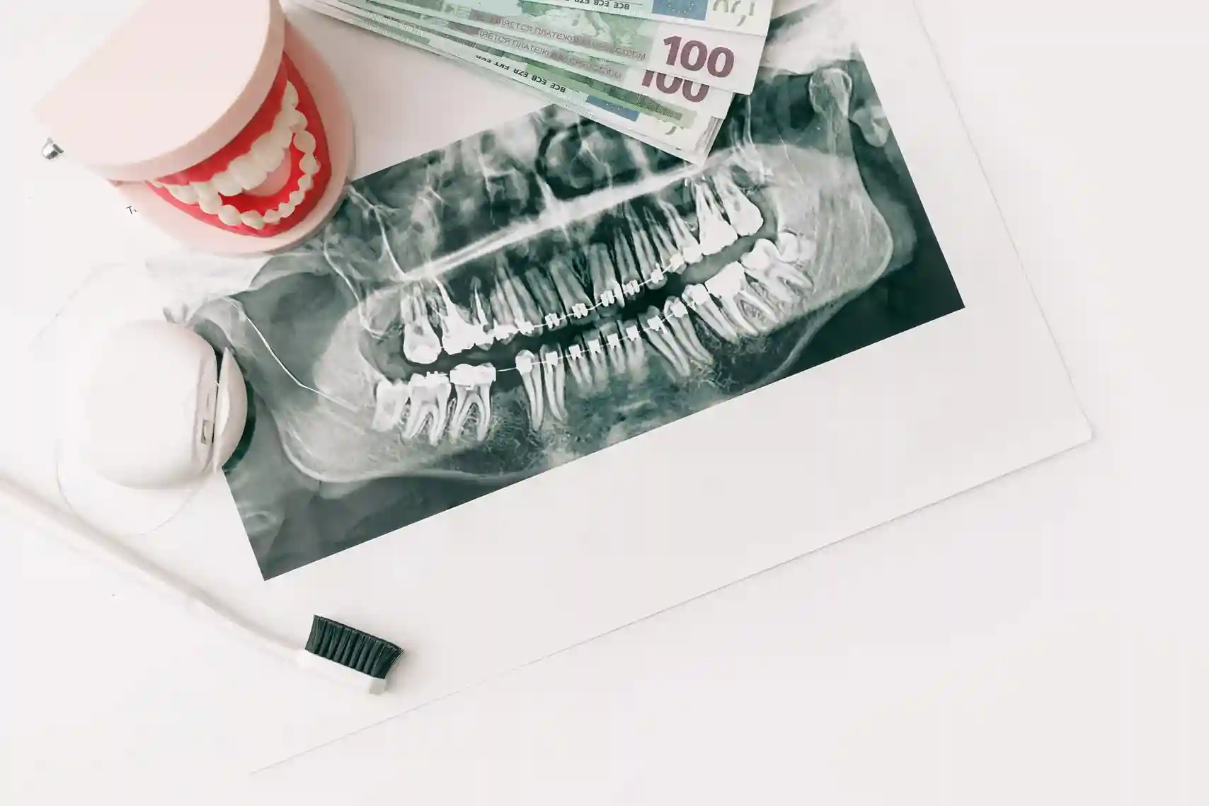 Dental X-ray, toothbrush, and model teeth with cash – concept of using a limited purpose FSA for dental expenses.
