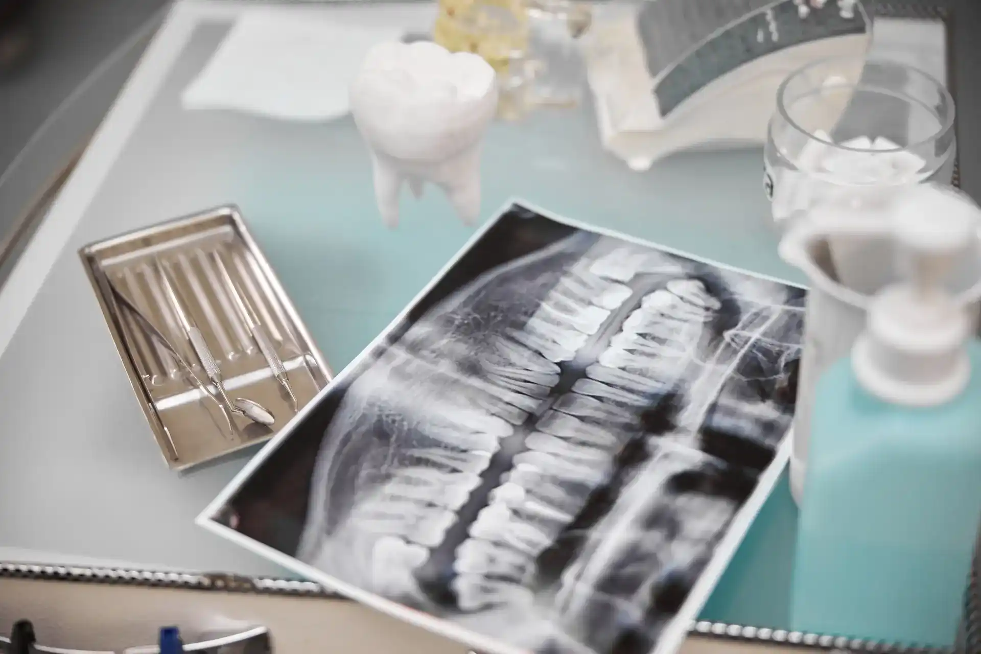 FMX dental X-ray image used for ADA code D0210 and complete oral evaluation.