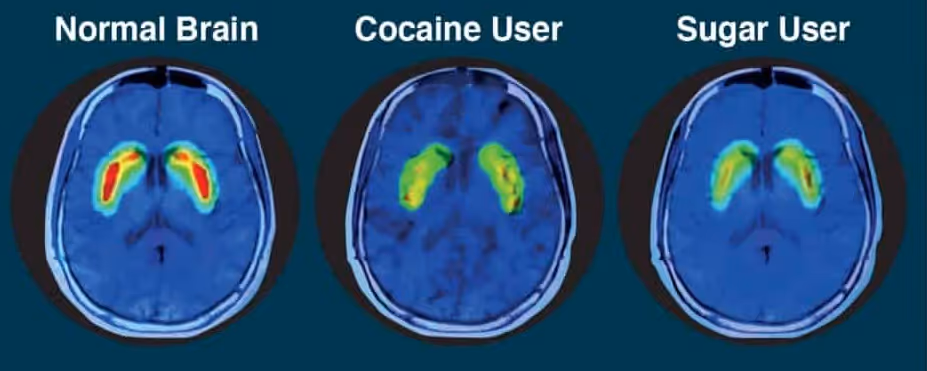 Sugar Graphic Image21 - Bwiti House Iboga retreat