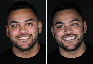 Side-by-side portraits of a smiling man with short dark hair and a beard against a black background.